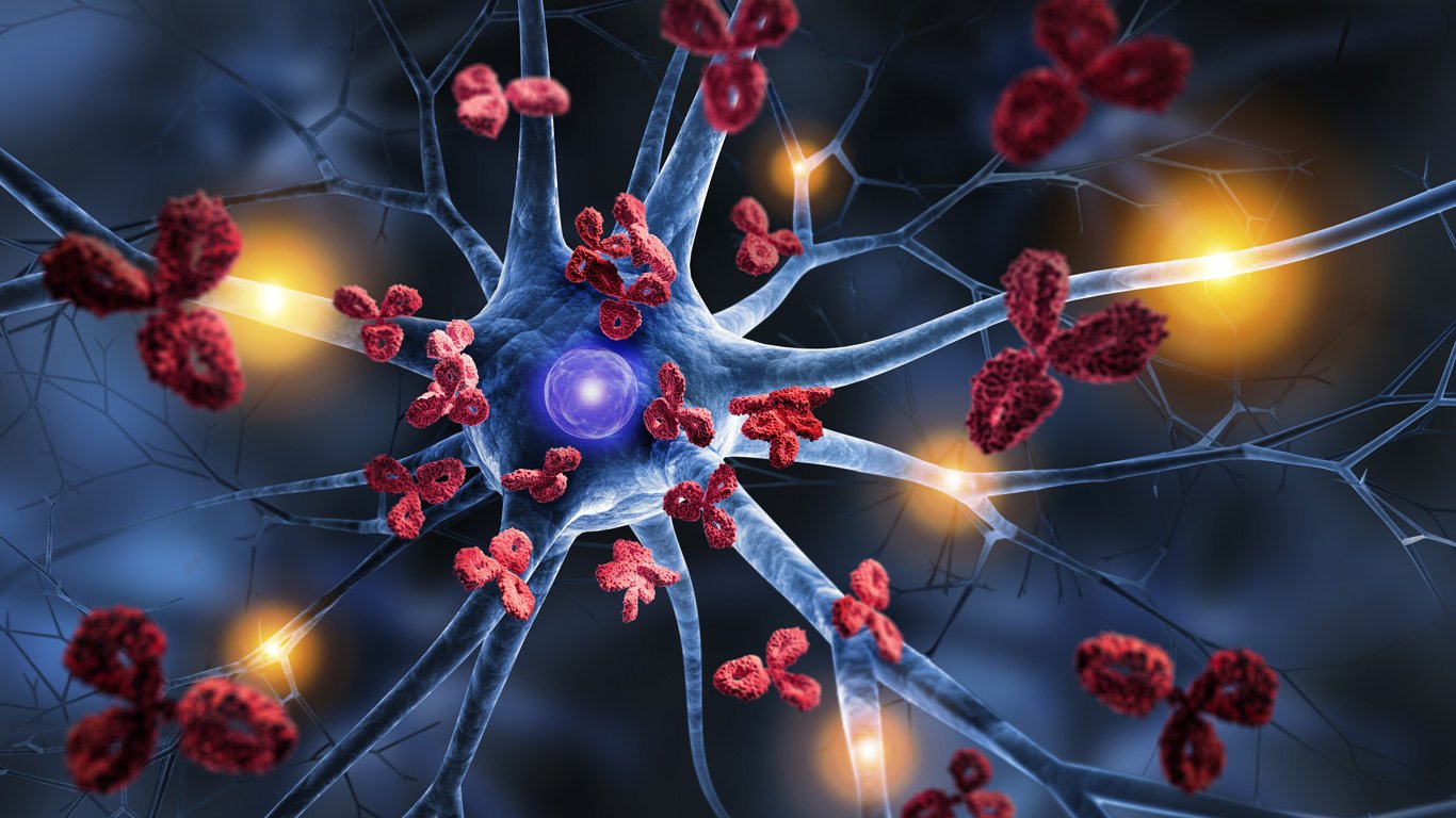 Autoimmune disorder nerve attack