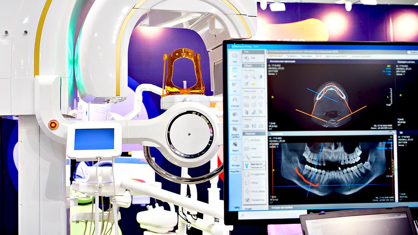 Implant Guided Surgery