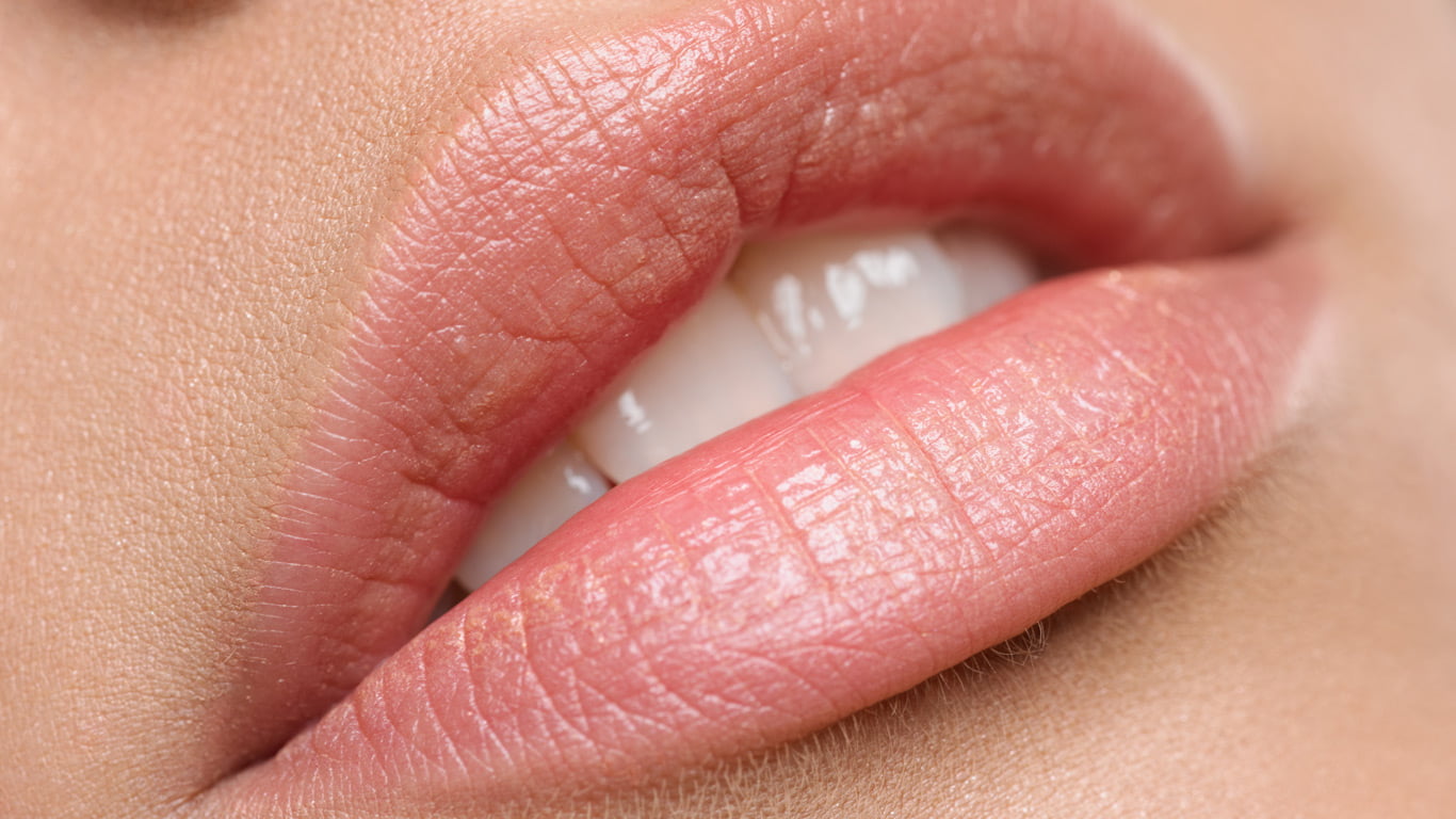 Lip filler