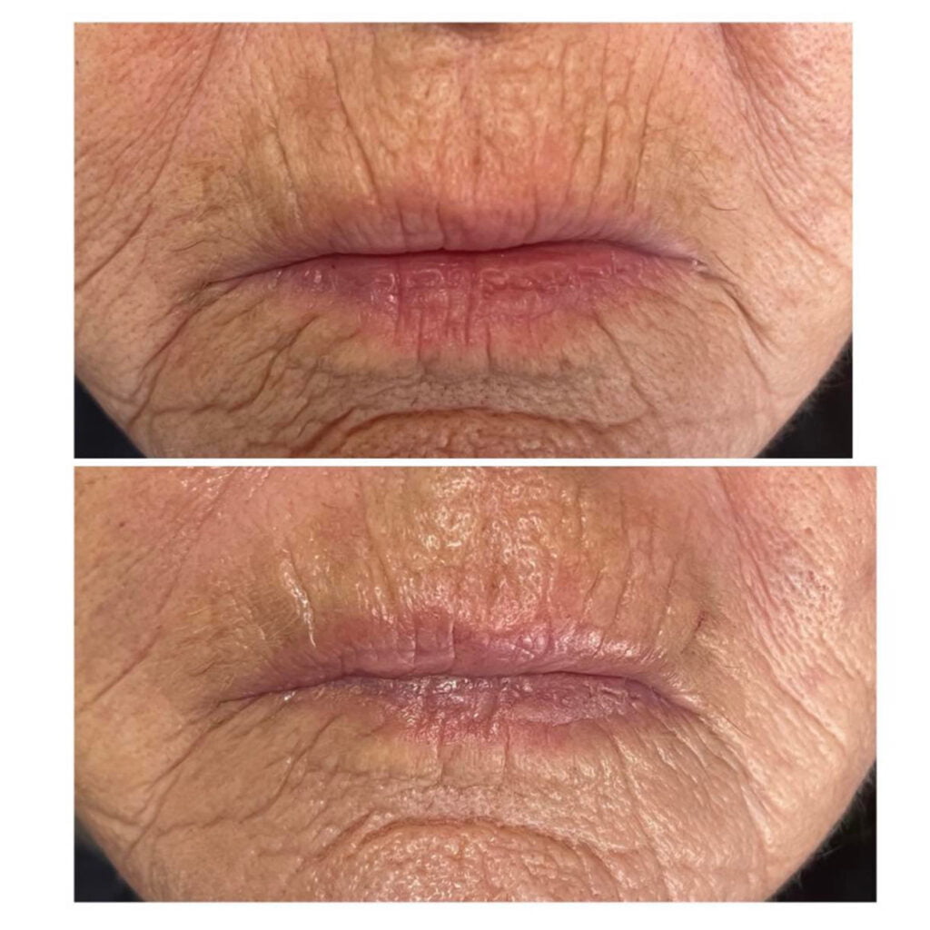 301815098_3155194574795389_8994124255362523334_n