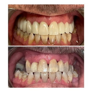 Tracey Bell - Blog 2