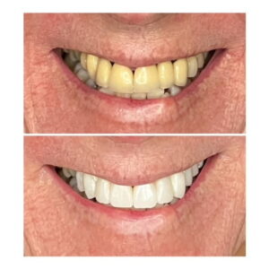 Tracey Bell - Blog 2 - Photo 2