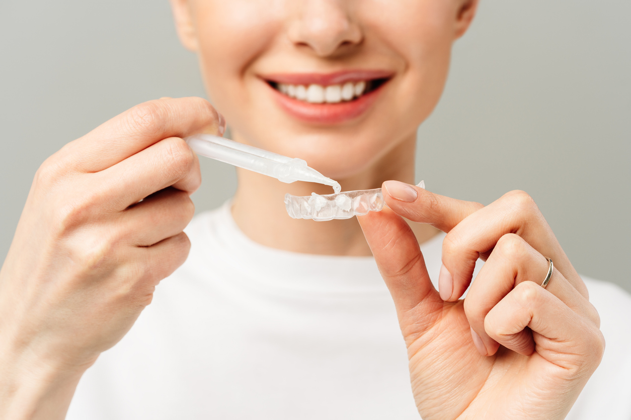 teeth whitening procedure. Whitening tray with gel
