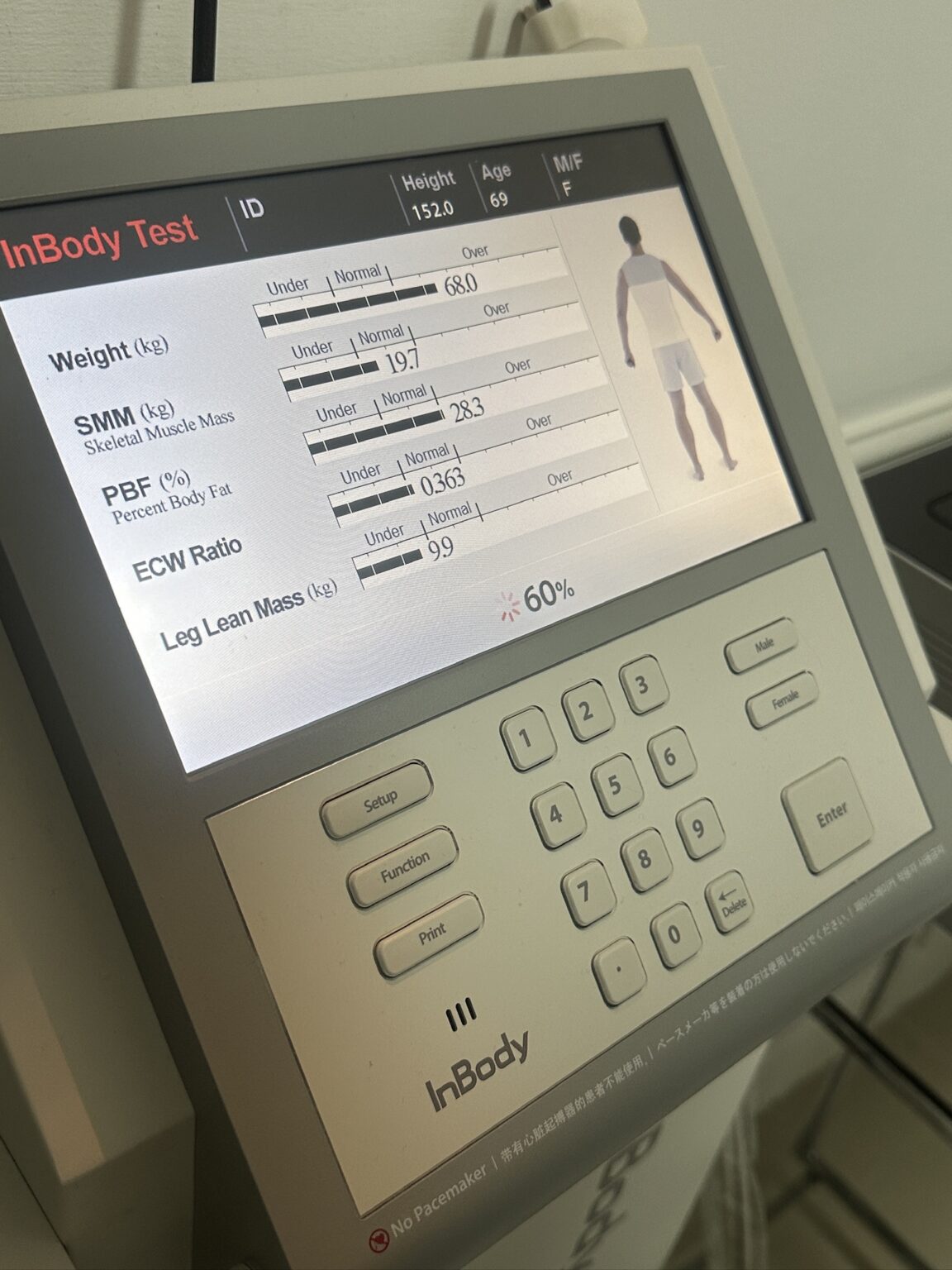 The InBody Machine at Tracey Bell | Dentist Isle of Man